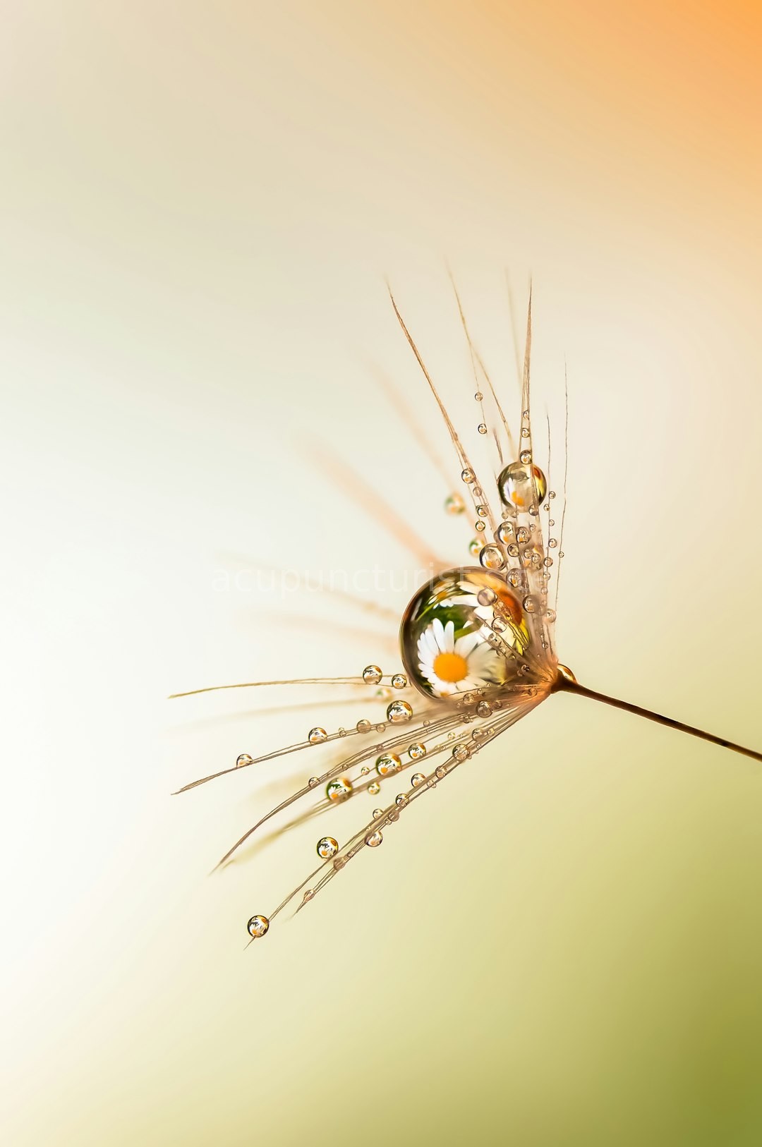 Acupuncture Detail